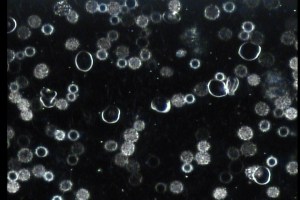 Blood 1 April29 2015